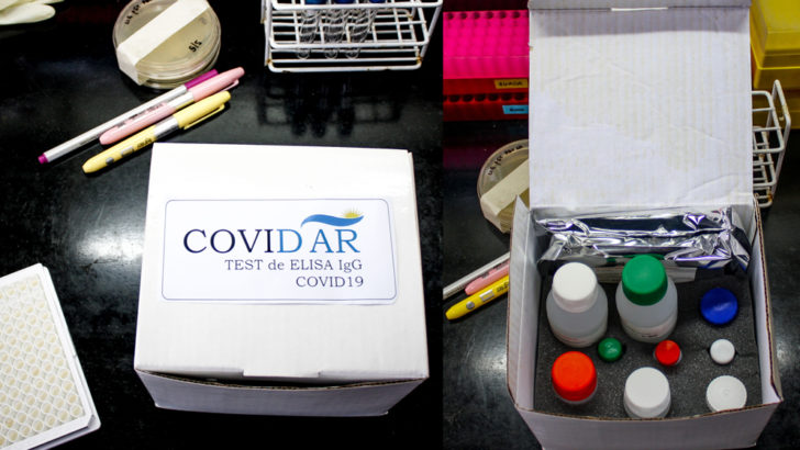 CovidAR llegó a los 100 mil test serológicos argentinos