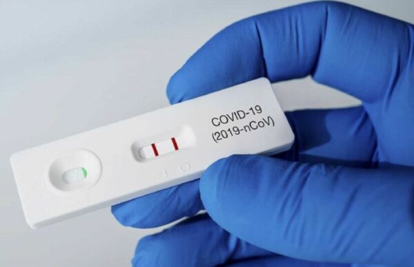 Autotest de coronavirus: ya están disponibles en farmacias para su venta al público
