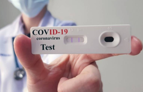 El uso de cuatro test de autoevaluación de Covid 19 están autorizados y vigentes en el país