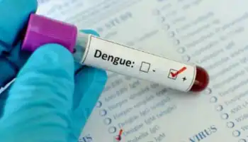 Salud Pública informo 2811 casos positivos de Dengue 3